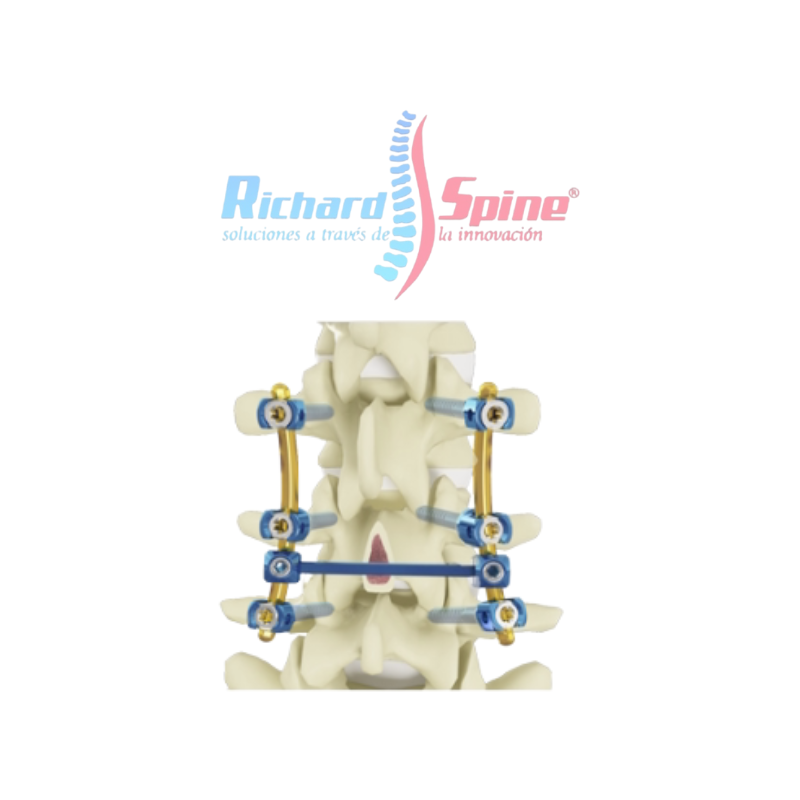 Sistema de fijación toracolumbar de Platino 5.5