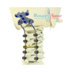 Sistema de Fijación Espinal Occipito-Cervicotorácica con Platino
