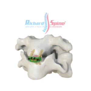 Placa de Fusión intercorporal cervical anterior