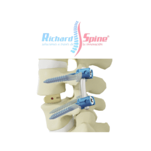 Caja de Fusión Intercorporal Torácica y Lumbar (PLIF)