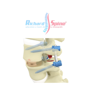 Caja de Fusión Intercorporal Torácica y Lumbar (TLIF)