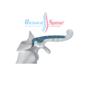 Placa de Bloqueo de Clavícula