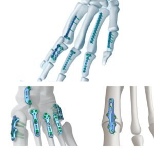 Placa para manos y pies